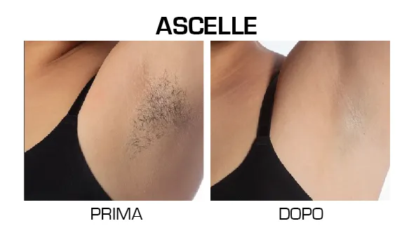 ascelle